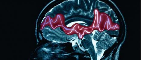 Nuova classificazione delle epilessie: convegno il 15 ottobre a Roccalumera