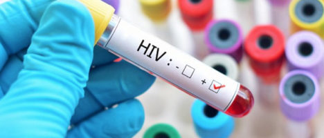 Preoccupazione per la resistenza ai farmaci contro l’hiv 