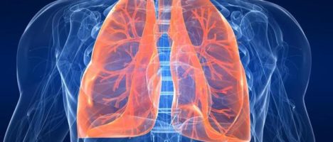 Tumore del polmone, una web fiction in 10 puntate lancia una nuova narrativa sulla malattia