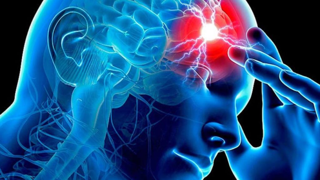 Percorso formativo “L’ictus cerebrale: linee guida diagnostico-terapeutiche”