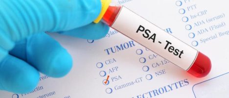 Da una ricerca italiana promettenti speranze per il superamento del PSA: l’Exo-PSA