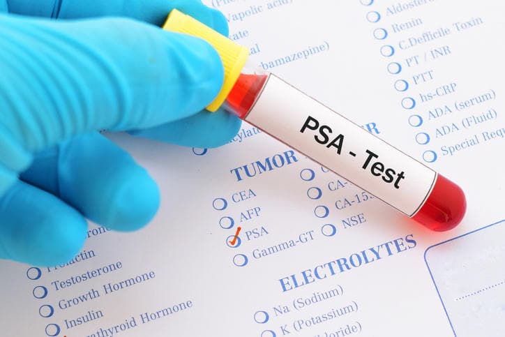 Da una ricerca italiana promettenti speranze per il superamento del PSA: l’Exo-PSA