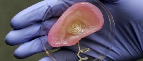 Rivoluzione nel mondo della chirurgia: stampante 3D costruisce l’orecchio a un bambino malato