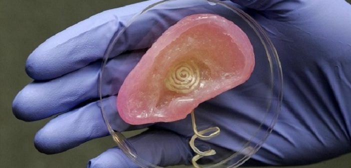 Rivoluzione nel mondo della chirurgia: stampante 3D costruisce l’orecchio a un bambino malato