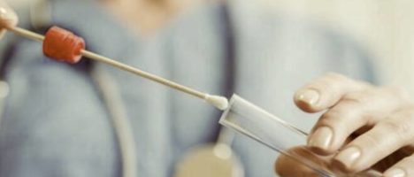 Disposizioni in materia di screening – utilizzo dei tamponi rapidi su card per la rilevazione qualitativa di antigeni specifici per SARS Cov-2 da prelievo rinofaringeo – indicazioni operative