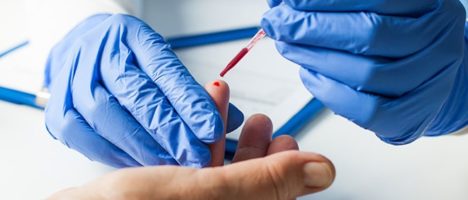 Aggiornamento disposizioni in materia di test sierologici per la ricerca di anticorpi anti SARS-CoV- 2- e dei tamponi