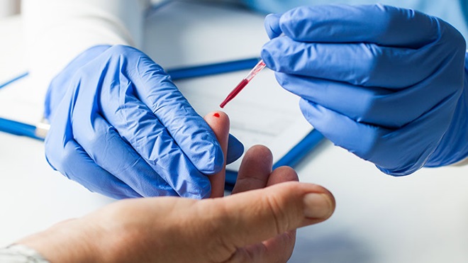 Aggiornamento disposizioni in materia di test sierologici per la ricerca di anticorpi anti SARS-CoV- 2- e dei tamponi