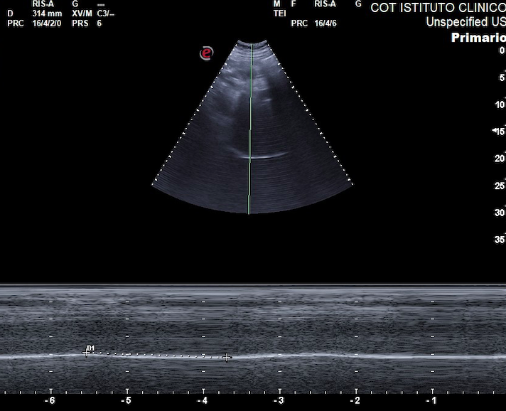 Covid-19: approfondimento scientifico alla luce dell’esperienza clinica dell’Istituto COT di Messina