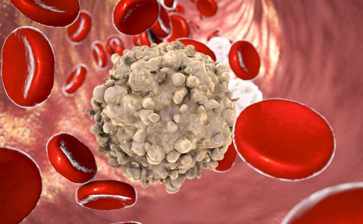 Amadori (AIL): con tumore sangue rischio letalità più alto 40%. “Reparti oncoematologia anche in prima ondata hanno garantito cure”