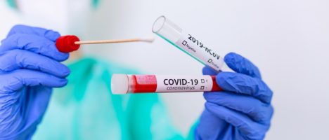 Intervallo temporale tra la somministrazione dei vaccini anti-SARS-CoV2/COVID-19 e altri vaccini