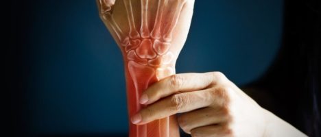 Aifa approva la rimborsabilità in Italia di RINVOQ (upadacitinib) per il trattamento dell’artrite reumatoide attiva di grado da moderato a severo