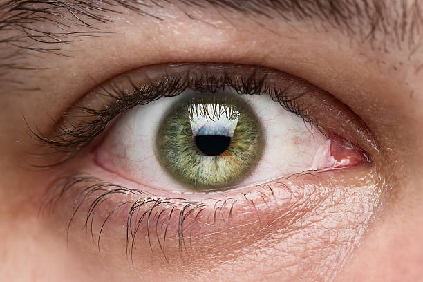 Gli oculisti: “non solo colliri, ci sono anche laser o chirurgia mininvasiva”