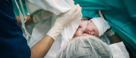 Il parto cesareo è più sicuro di quello naturale?