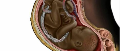 Un feto nero nei manuali di medicina: lo studente che combatte il razzismo delle illustrazioni scientifiche
