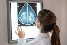 Conviene rimuovere seno e ovaie sane per prevenire un tumore?