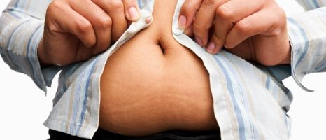 Giornata mondiale dell’obesità: L’impegno dei pediatri dell’AOU “G. Martino” di Messina per evitare il sovrappeso nei bambini
