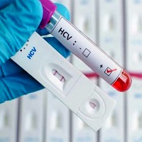 Concluso progetto ASL Napoli 2 Nord di eradicazione Ospedaliero “Cinquanta senza C” – Riscontrati 500 positivi a HCV su 7.500 screenati