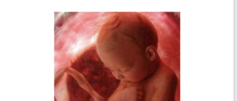 Al via la II edizione del corso “Dalla diagnosi prenatale all’outcome neonatale: le nuove frontiere della medicina e chirurgia fetale”