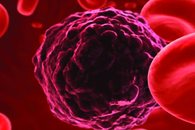 Una innovativa biopsia liquida apre la strada a una diagnosi tempestiva di lesioni precancerose al colon retto nei pazienti con sindrome di Lynch