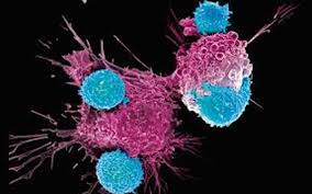 CAR-T, un nuovo paradigma nel trattamento dei tumori. AIL riunisce a Roma importanti specialisti in oncoematologia per fare il punto sullo stato dell’arte e le prospettive future