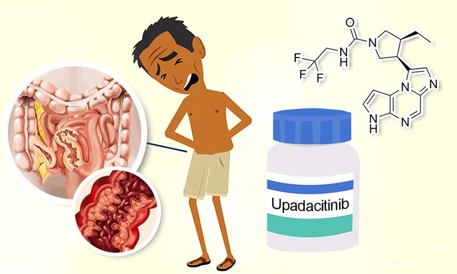 La Commissione Europea approva Upadacitinib per il trattamento della Arterite a cellule giganti