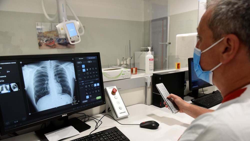 Tornare a camminare dopo una lesione al midollo grazie alla stimolazione elettrica