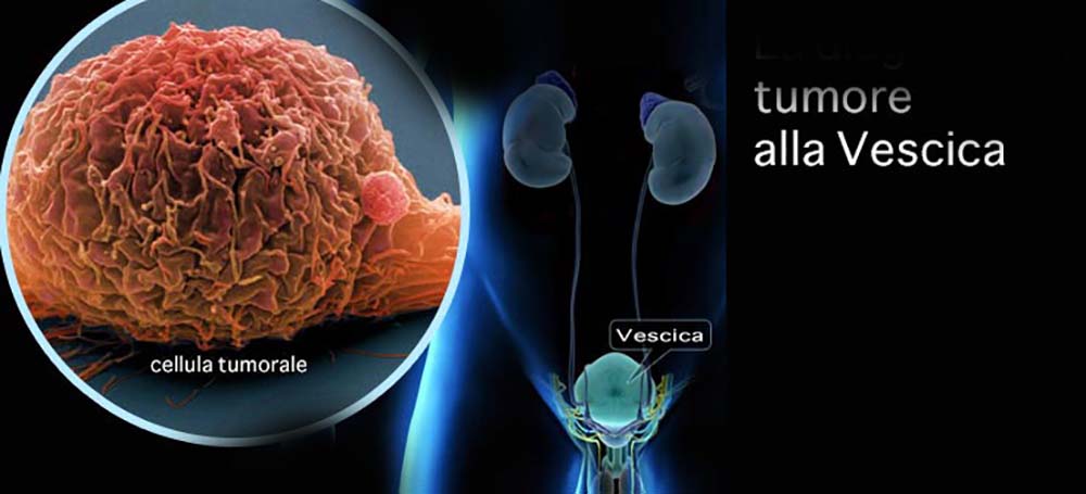 Studio internazionale pubblicato su Journal of Clinical Oncology
