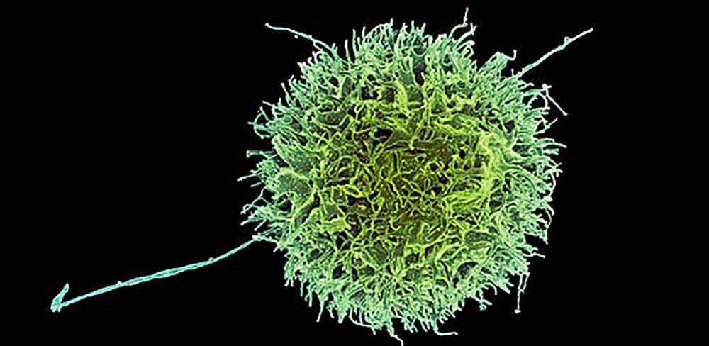 Nuovo Metodo per Generare Cellule Natural Killer (NK) per l’Immunoterapia Oncologica