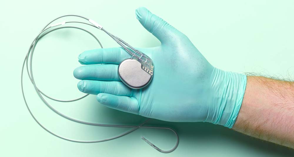 Chi è portatore di un pacemaker o defibrillatore cardiaco può continuare a guidare la macchina?
