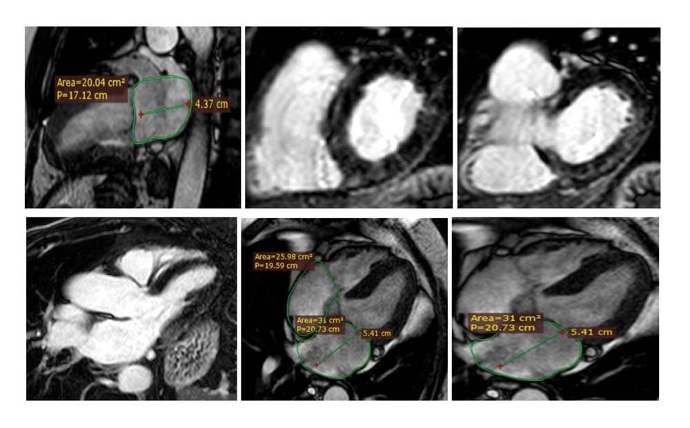 L’emodinamica di Patti collabora con le Radiologie di Milazzo e Barcellona Pozzo di Gotto per l’attivazione della Risonanza Magnetica Cardiaca