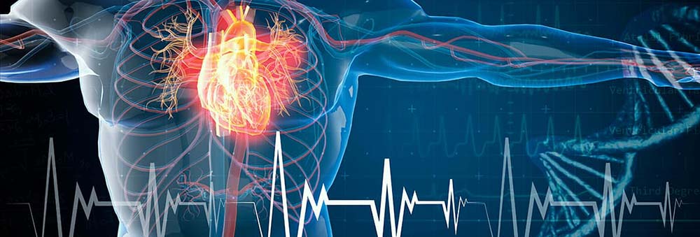 Malattie cardiovascolari: l’Italia ha urgenza di una strategia nazionale. L’Europa insegna come fare