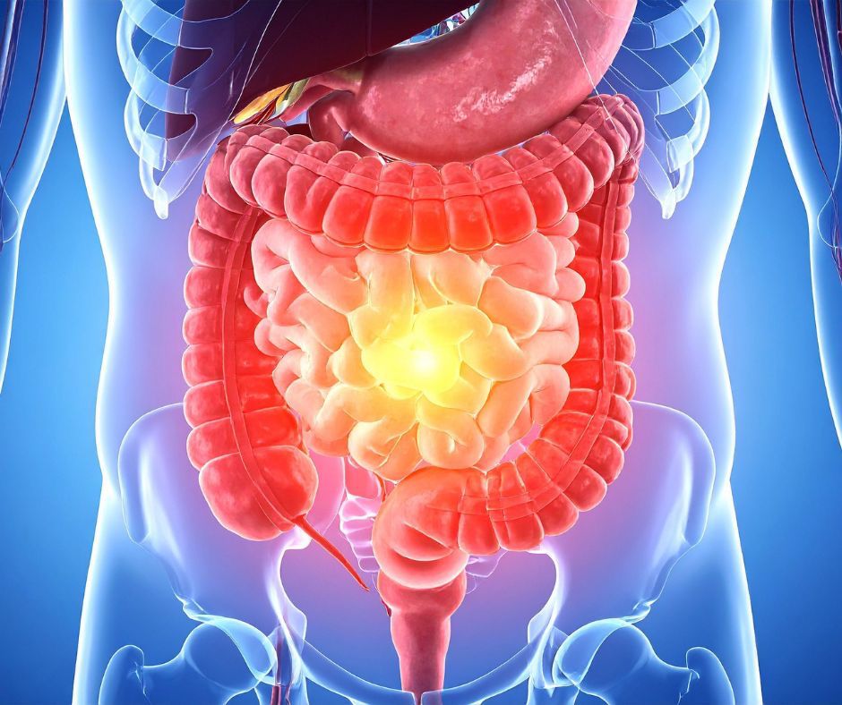 Malattie infiammatorie croniche intestinali: Il 31 Gennaio al Policlinico di Messina un focus su bambini e adulti