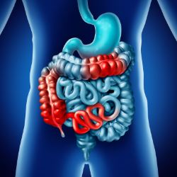Colite ulcerosa e malattia di Crohn: in Sicilia ci convivono tra 22.000-25.000 persone, con numeri in aumento nella fascia d’età pediatrica giovanile adulta. Menzione di merito per l’eccellenza dell’Azienda Ospedaliera Ospedali Riuniti (AOOR) Villa Sofia- Cervello di Palermo