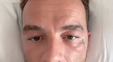 “Caro Salmo, il basalioma non si cura con i TikTok”: la lezione di dermatologia che il web deve ascoltare